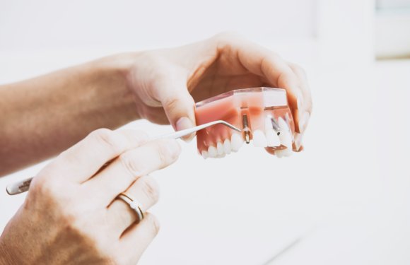 How Long Does It Take To Recover From A Wisdom Tooth Extraction?