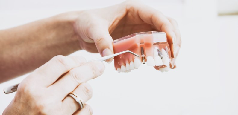 How Long Does It Take To Recover From A Wisdom Tooth Extraction?