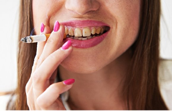 How Can Say! Does Smoking Affect Teeth and Gums